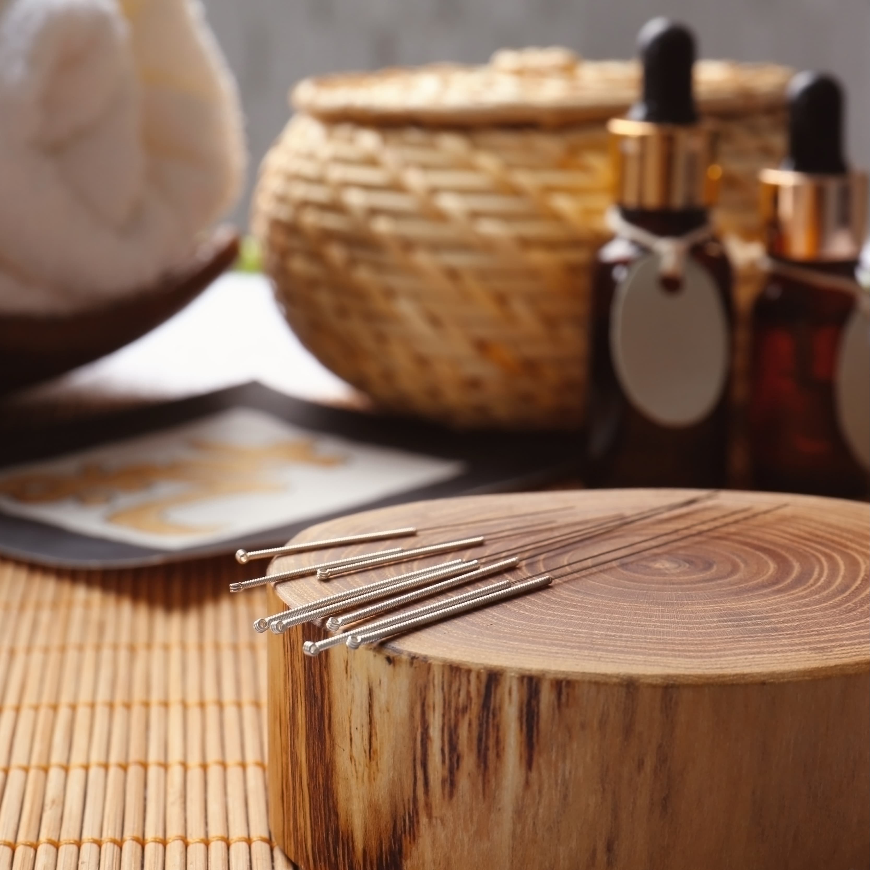 Acupuncture 101 What You Need to Know Before Starting Acupuncture